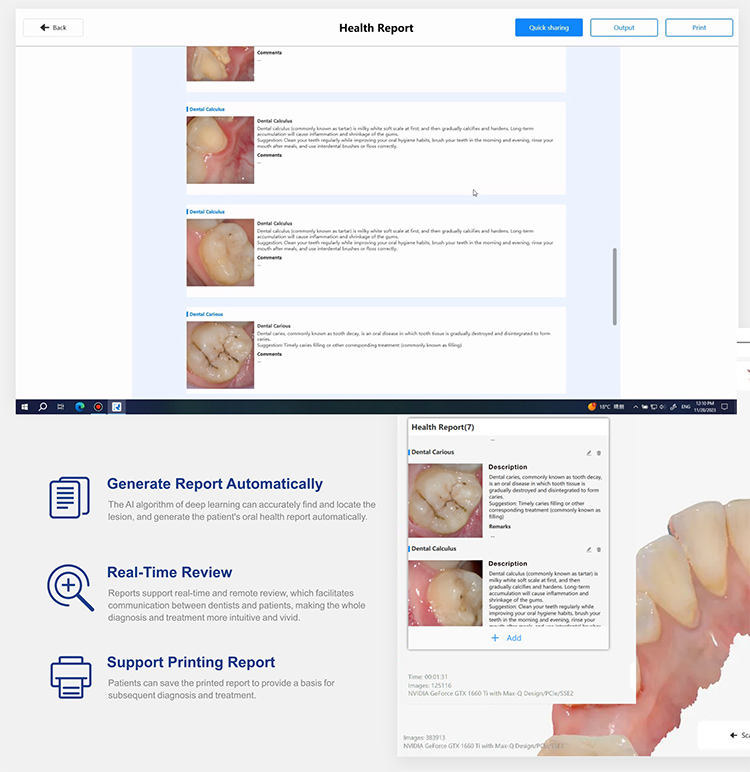 IOS33 Intraoral Scanner